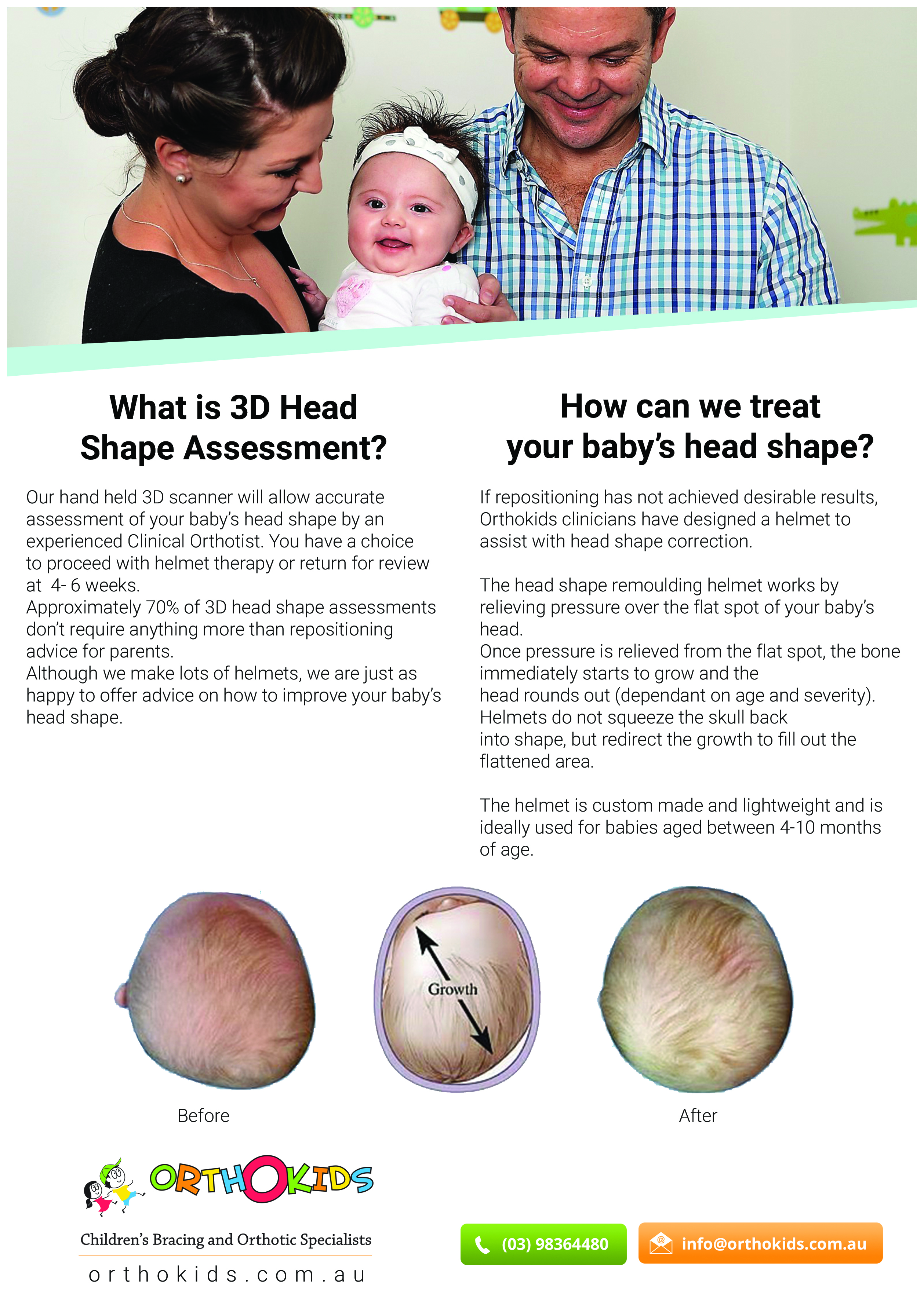 Assessment and evaluation for baby's flat head plagiocephaly