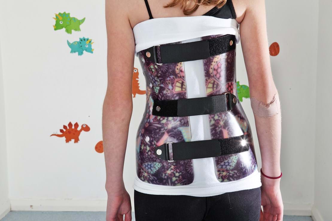 Scoliosis brace - Patterned Butterfly and Black straps