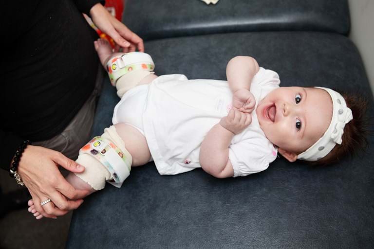 Children's Orthopaedic Braces Orthokids Hip Dysplasia