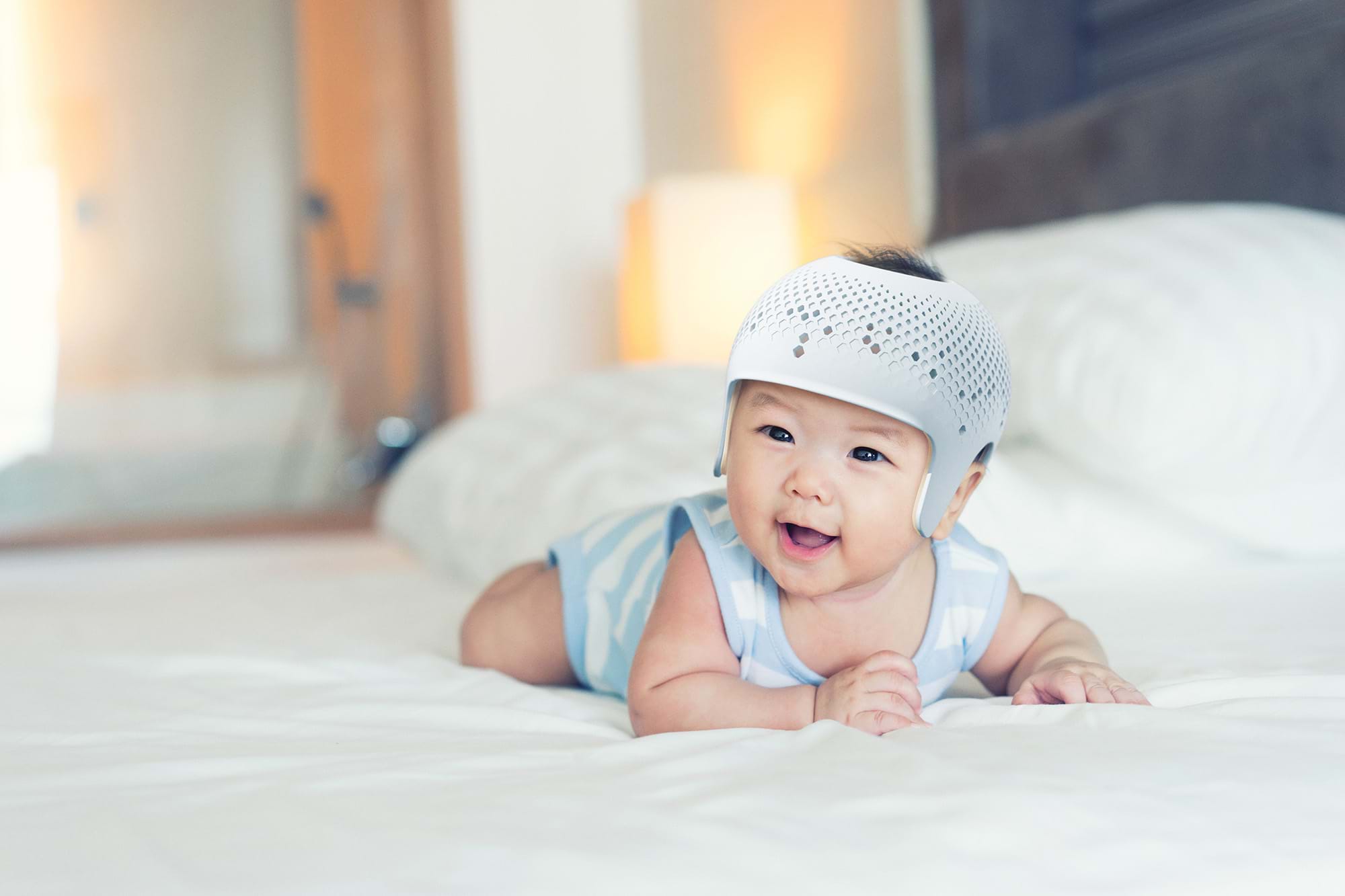 3D Head Shape Assessment for your baby's flat head plagiocephaly